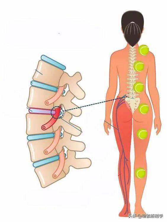 9大身体常见部位疼痛，一个网球帮你全部搞定（收藏级）